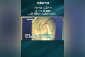 画面高能！女子长期腹痛，从肠里取出20厘米长蛔虫#江苏dou知道 #政媒原创作者联盟 视频封面