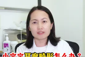 小宝宝耳廓畸形怎么办？一个视频读懂系列科普 #硬核健康科普行动 #耳廓矫正  #招风耳宝宝 #一个视频整明明白白的视频封面