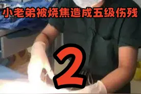 18岁小伙去医院割包皮，不料竟然遇到兽医，小老弟烧焦五级伤残 #真实事件 #社会百态 #奇闻趣事视频封面