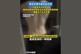 医生称男生长得又高又白又帅，可能是克氏综合征，是男性群体中较常见的染色体异常疾病，一般情况下无法生育