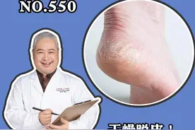 脚后跟经常起皮开裂，教你一招解决#医学科普 #皮肤 