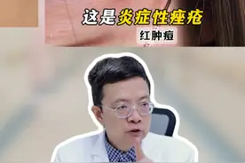 30秒教你分清痘痘类型，针对性处理#痘痘 #痤疮 #囊肿型痤疮 #抖出健康知识宝藏  #变美视频封面