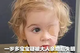 1岁多宝宝疑被大人亲吻后失明 医生：感染疱疹病毒致眼角膜穿孔 经历多次手术视力仍未恢复视频封面