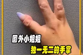 国外小姐姐独一无二的手掌，值得一看#涨知识 #有趣的冷知识 #科普 #奇闻趣事视频封面