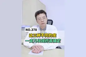 三种不同类型的HPV感染，一支几块钱的小钱教你搞定！#疣 #跖疣 #瘊子 #硬核健康科普行动  #张堂德视频封面
