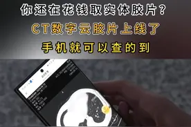 你还在花钱取实体胶片？CT数字云胶片上线了，手机就可以查的到！#医院 #医疗 #影像