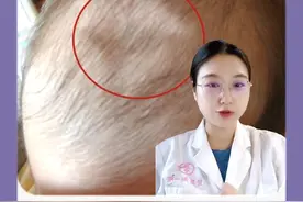 宝宝囟门很脆弱！家长一定要注意好这2点！警惕这些异常情况 #医学科普 #硬核健康科普行动  #宝宝 #新生儿 #囟门视频封面