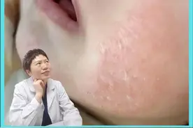 婴儿湿疹不要急，父母试试这个处理方法 #医学科普 #育儿经验分享 #婴儿湿疹 #硬核健康科普行动 #新手爸妈必看视频封面