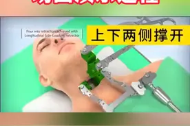 颈椎前路手术 动画演示过程 #颈椎 #颈椎病 #硬核健康科普行动 #AI分身24小时健康陪伴 #医疗创作者培优计划视频封面