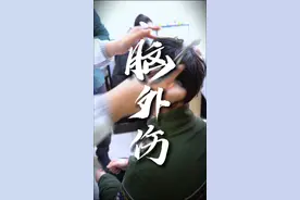 弟弟，不幸遇车祸，脑外伤，头总是晕晕的，看看有什么好办法？#头晕  #脑外伤  #脑出血  #放血疗法 #曹燕