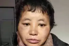 贵港桂平寻亲：中年女子被救助，高1米55，穿黑色长款皮衣图片