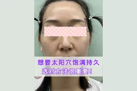 想要太阳穴饱满持久，选对方法很重要！#太阳穴凹陷 #面部凹陷 #变美 #硬核健康科普行动