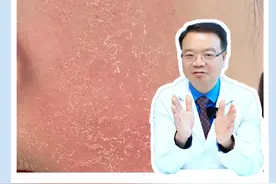 脸上干痒发红还起皮，是不是换季过敏了？#皮肤科医生谢红付 #硬核健康科普行动视频封面