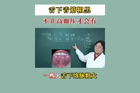 #舌下青筋 #医学科普小知识