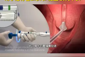 3D动画带你了解 宫颈扩张术#宫颈 #关爱女性健康 #医学科普视频封面