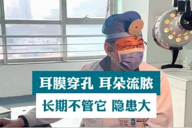 耳膜穿孔 耳朵流脓，长期不管它 后期隐患大。#耳膜穿孔 #鼓膜穿孔 #耳朵流脓 #耳鼻喉刘军
