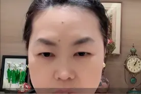 上曼月乐后腿肿别慌，听听医生怎么说 #曼月乐环 #女性健康 #抖出健康知识宝藏 #在抖音pick你的健康搭子 #解锁春日健康清单视频封面