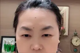 上曼月乐后腿肿别慌，听听医生怎么说 #曼月乐环 #女性健康 #抖出健康知识宝藏 #在抖音pick你的健康搭子 #解锁春日健康清单视频封面