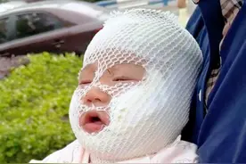 宝宝湿疹总反复，一换季就长红点，经常痒得睡不着， 别担心，皮肤科医生手把手教你治疗#宝宝湿疹 #湿疹 #皮肤 #痒 #科普视频封面