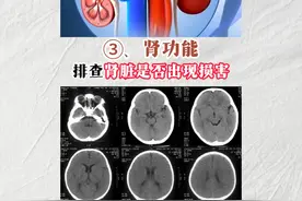高血压患者，如果收缩压大于140，舒张压大于90，建议做以下这五项检查，检查费用从几十块到两三百块不等，早检查早发现早预防早治疗！#高血压 #冠心病 #心病科王骕医生 #心力衰竭视频封面