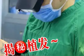 揭秘植发手术全过程！ #植发 #硬核健康科普行动  #北京植发王继萍 #脱发视频封面