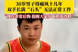#30岁男子得痛风十几年双手长满石头  ，无法正常工作，一家四口全靠妻子一人维持。当事人：现在非常后悔，提醒大家要少喝奶茶饮料。#痛风 #痛风石 #饮料