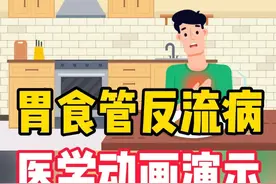 胃食管反流病的症状表现和治疗都是什么样的，一个动画告诉你。#医学科普 #医生日常 #反酸烧心 #医疗健康创作训练营 #用健康的方式做不健康的事视频封面
