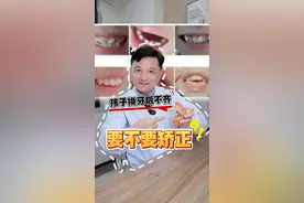 孩子换牙后不齐需要做矫正吗？ #医学科普 #口腔医生 #武大口腔 #抖出健康知识宝藏 #矫正
