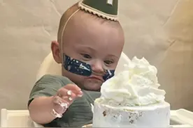 孕五个月就出生 体重仅285克 全球“最早早产儿”迎来1岁生日 仍要靠插氧管帮助呼吸、插食管喂食 母亲：第一次抱他时几乎感受不到重量#新闻 #热点 #早产儿 #美国视频封面