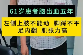61岁患者脑出血5年 左侧上肢不能动  脚踩不平 足内翻  肌张力高#周围神经外科医生廉民学 #肌张力高 #足内翻  #硬核健康科普行动视频封面