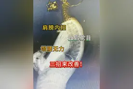 肩膀内扣、耸肩驼背、塌腰无力、三招来改善！ #耸肩驼背 #肩膀内扣 #塌腰无力 #抖出健康知识宝藏  #开工去班味健康指南