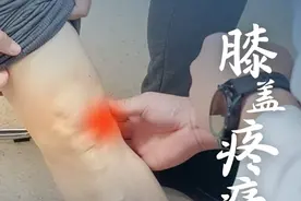 老年人膝盖疼，不是必须手术，医生：保守治疗缓解症状延缓退化 #硬核健康科普行动 #年度健康知识干货大赏 #膝盖疼 #膝关节疼痛 #保膝医生贾俊秀 @脊柱医生时宗庭视频封面