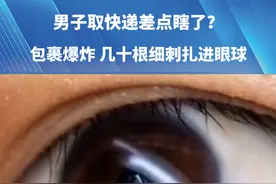 这就是现实版的“暴雨梨花针”吗？#眼睛里有异物怎么取出来 #科普 #不可思议 #意外 #神操作视频封面