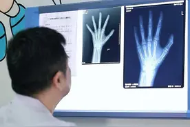 12岁男孩骨龄14岁生长空间还有多少？ 12岁男孩骨龄14岁生长空间还有多少？#健康无畏自在如她 #医学科普 #生长发育 视频封面