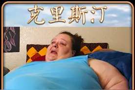800斤大胖子，肚子上长了个巨大的瘤子 #纳神医 #沉重人生减肥