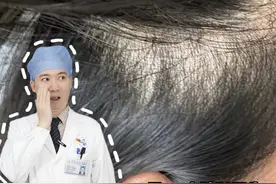 得了脂溢性脱发，不吃药也能治好！？#脂溢性脱发 #不吃药 #科普 #抖出健康知识宝藏 #脱发视频封面