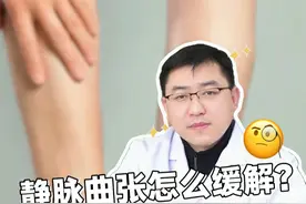 静脉曲张怎么缓解？试试这三个方法！ #静脉曲张 #静脉曲张怎么办 #医学科普 #抖出健康知识宝藏视频封面