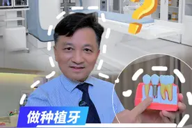 做完种植牙会影响你做核磁共振吗？ #医学科普 #硬核健康科普行动  #牙医日常 #种植牙