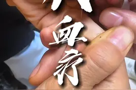 四缝穴放血法，有什么作用你知道吗？#失眠  #痛风 #放血疗法 #小儿腹泻 #徐世芬视频封面