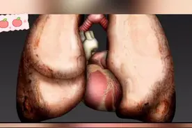 心电图上边的波形你知道是什么意思吗 心电图上边的波形你知道是什么意思吗#医者仁心 #医学科普 #心电图 #3D科普 视频封面