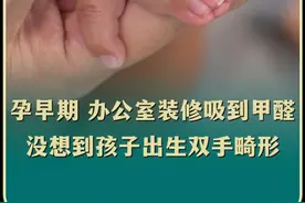 怀孕的时候，办公室装修 不小心吸到甲醛，没想到孩子出生时是畸形#甲醛 #孕检 #并指 #畸形视频封面