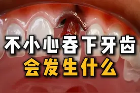 不小心吞下一颗牙齿会发生什么 #科普视频封面