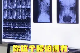 常年腰痛？ #腰痛 #腰痛改善 #硬核健康科普行动  #腰痛怎么办 #腰疼