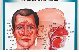中耳炎为啥跟鼻窦炎密切相关，为啥有些人明明只有鼻窦炎，却出现中耳炎，今天简单说下#鼻窦炎 #中耳炎 #中医调理 #耳鼻喉名中医高仁虎 #鼻炎视频封面