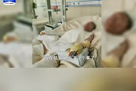 起火原因疑为液化气泄露，村民讲述烧伤女孩坎坷经历，家中至今还有七八万外债（二）#石家庄 视频封面