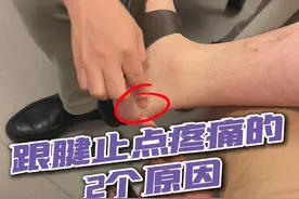 跟腱止点疼痛的2个原因 #硬核健康科普行动  #痛风 #跟腱疼痛 #跟腱止点炎视频封面