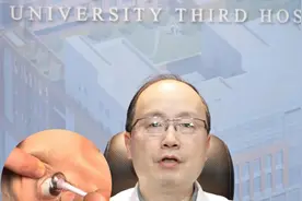 近视手术前一定要提前停戴一周的时间！ #抖出健康知识宝藏  #眼科医生陈跃国 #医疗健康创作训练营 #近视手术 #隐形眼镜视频封面