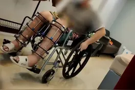 “断骨增高”被伪造成“腿型矫正”，医生伪造病历，违规手术变“正规”，律师：可能涉嫌伪造证据罪。视频封面