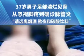 37岁男子（@只吃香菜 ）足部溃烂见骨，从忽视脚疼到确诊脉管炎 ，“请远离烟酒 熬夜和碳酸饮料” #脉管炎 #健康科普 #媒体精选计划