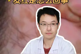 白癜风的白斑发红是怎么回事？ #白癜风 #白斑 #医学科普 #皮肤问题 #硬核健康科普行动视频封面